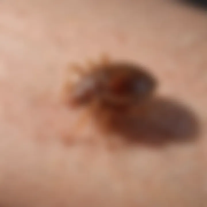 Illustration of bed bug bite marks on skin