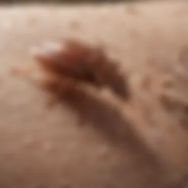 Skin rash caused by bed bug bites