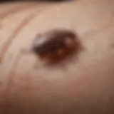 Close-up of skin showing bed bug bites